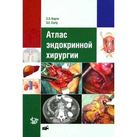 Эндокринология, книга Атлас эндокринной хирургии заказать