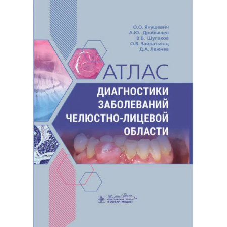 Стоматология, книга Атлас диагностики заболеваний челюстно-лицевой области заказать