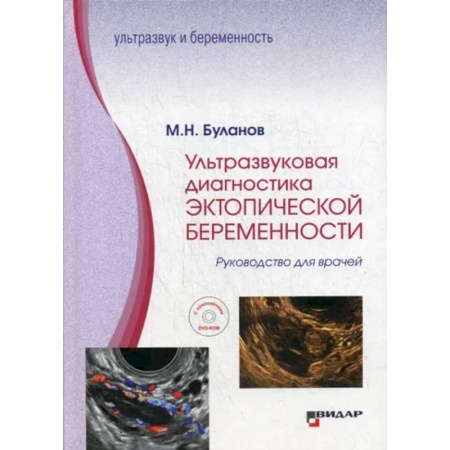 УЗИ. ЭКГ. Томография. Рентген, книга Ультразвуковая диагностика эктопической беременности заказать