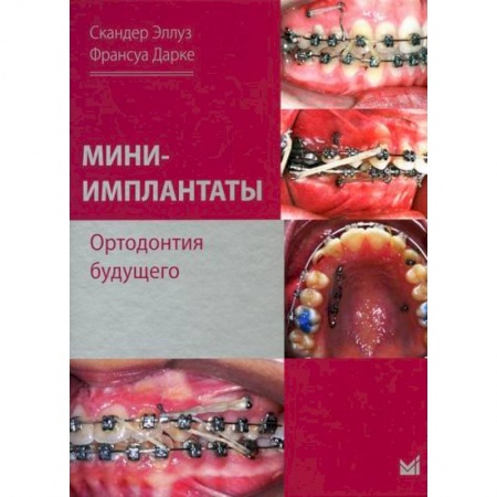 Стоматология, книга Мини-имплантаты. Ортодонтия будущего заказать