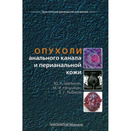 Онкология, книга Опухоли анального канала и перианальной кожи заказать