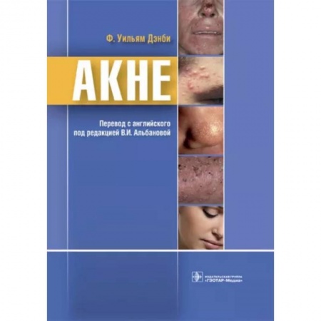 Кожные и венерические болезни, книга Акне заказать