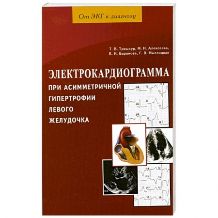 Книги, книга Электрокардиограмма при асимметричной гипертрофии левого желудочка заказать