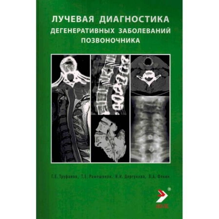 Диагностика. Методы и виды, книга Лучевая диагностика дегенеративных заболеваний позвоночника заказать