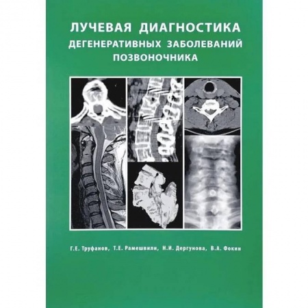 Другие виды специальной медицины, книга Лучевая диагностика  дегенеративных заболеваний позвоночника заказать