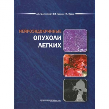 Онкология, книга Нейроэндокринные опухоли легких заказать