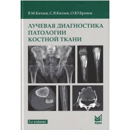 Медицинские энциклопедии и справочники, книга Лучевая диагностика патологии костной ткани заказать