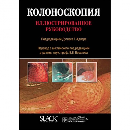 Гастроэнтерология, книга Колоноскопия. Иллюстрированное руководство заказать