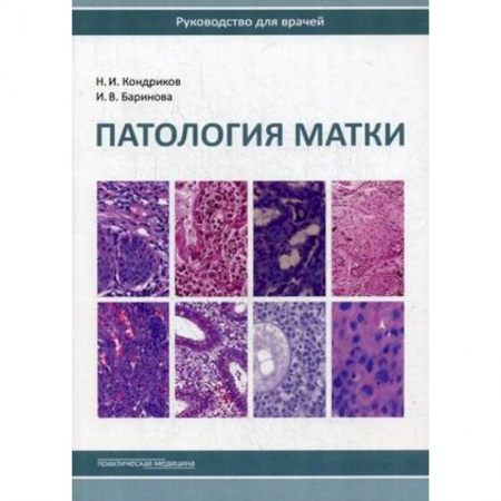 Акушерство и гинекология, книга Патология матки. Руководство для врачей заказать