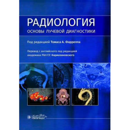 Другие виды специальной медицины, книга Радиология. Основы лучевой диагностики заказать