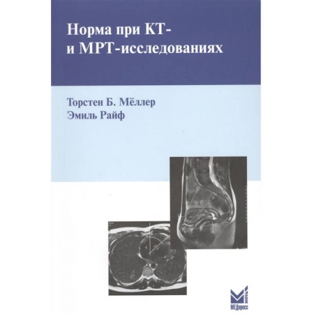 Фармакология. Рецептура. Токсикология, книга Норма при КТ- и МРТ-исследованиях. Мёллер Т.Б. заказать