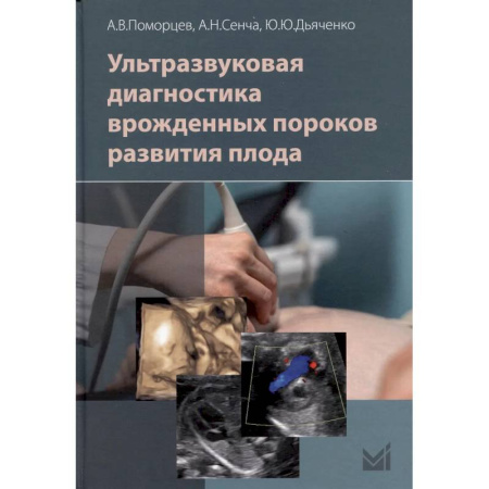 Диагностика. Методы и виды, книга Ультразвуковая диагностика врожденных пороков развития плода заказать