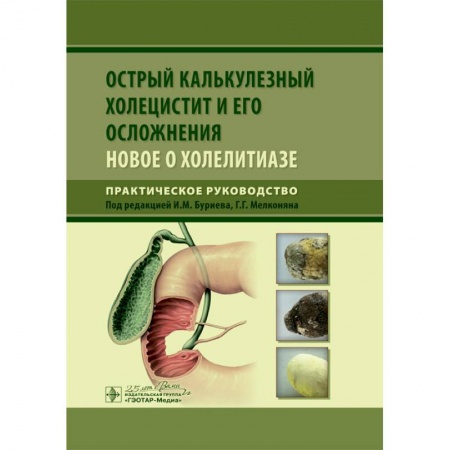 Хирургия. Ортопедия, книга Острый калькулезный холецистит и его осложнения. Новое о холелитиазе заказать