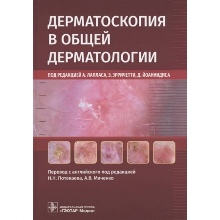 Кожные и венерические болезни, книга Дерматоскопия в общей дерматологии заказать