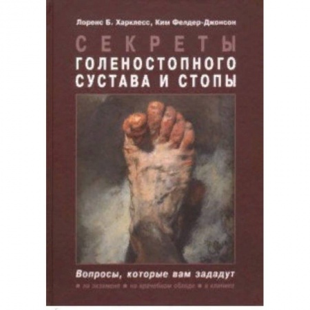 Хирургия. Ортопедия, книга Секреты голеностопного сустава и стопы заказать