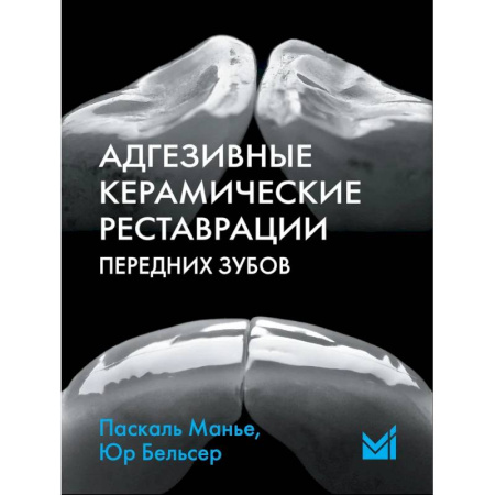 Стоматология, книга Адгезивные керамические реставрации передних зубов заказать