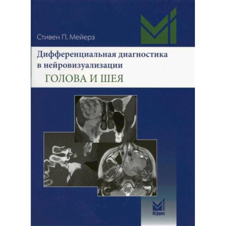 Позвоночник. Суставы. Артрит. Остеохондроз, книга Дифференциальная диагностика в нейровизуализации. Голова и шея заказать