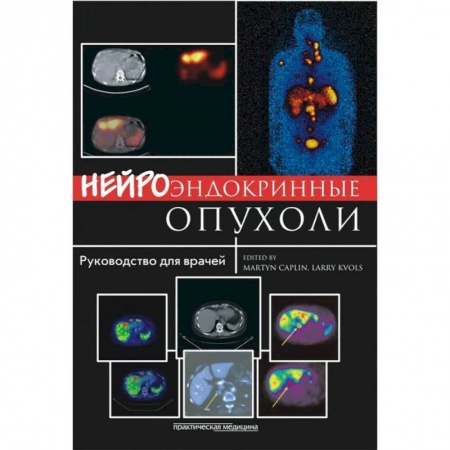 Онкология, книга Нейроэндокринные опухоли. Руководство для врачей заказать