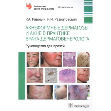 Медицина. Фармакология, книга Акнеформные дерматозы и акне в практике врача-дерматовенеролога: руководство для врачей заказать