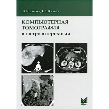 УЗИ. ЭКГ. Томография. Рентген, книга Компьютерная томография в гастроэнтерологии: руководство для врачей. заказать