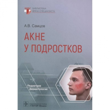 Книги, книга Акне у подростков заказать
